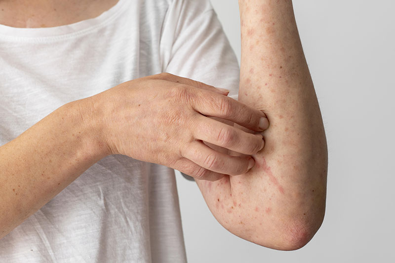 Arms with rashes